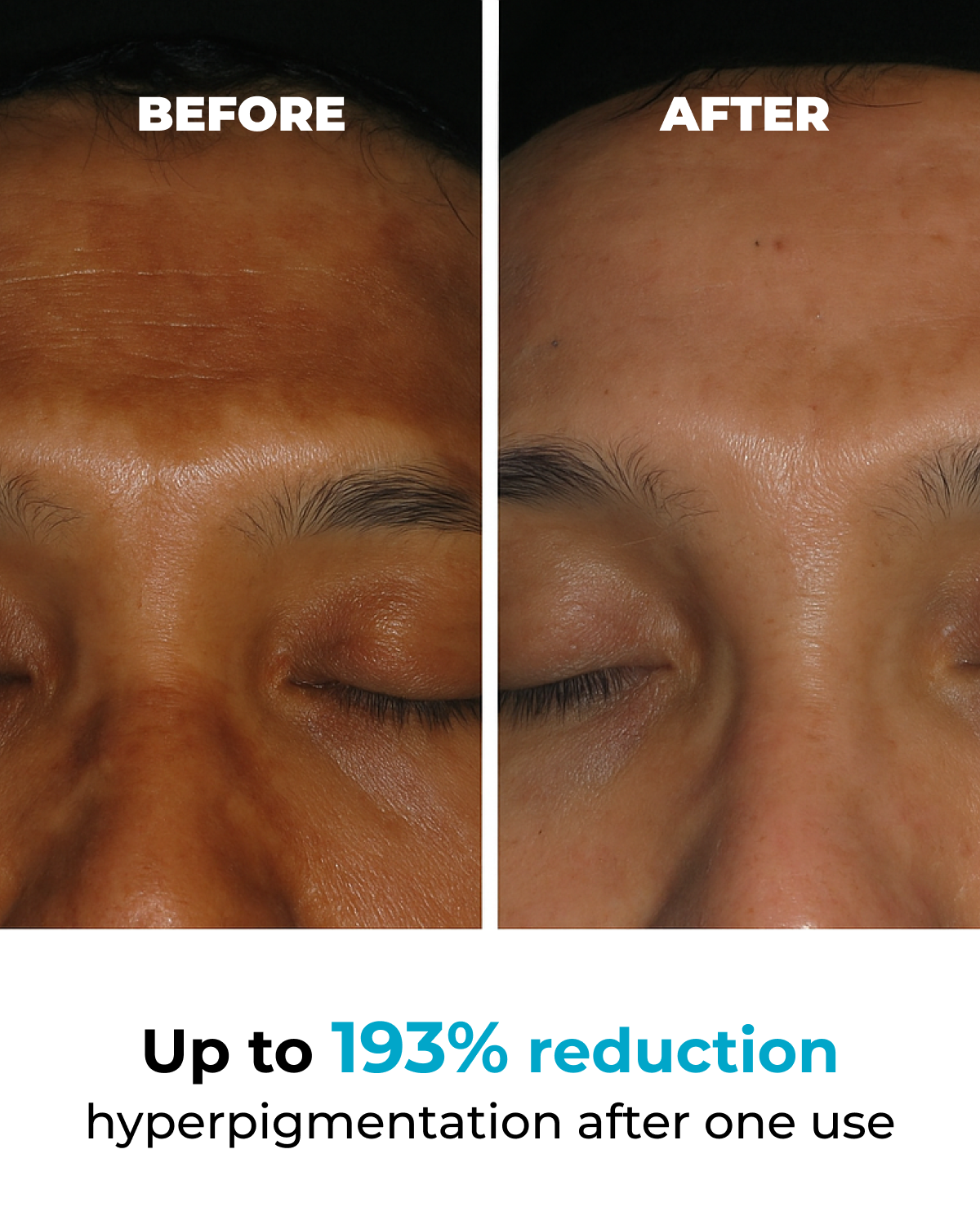 Viral Poción Corporal Jelly Booster para Pigmentación