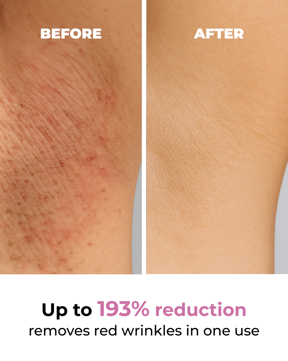 Viral Glazed Donut Aceite Post-Afeitado para Irritación y Manchas