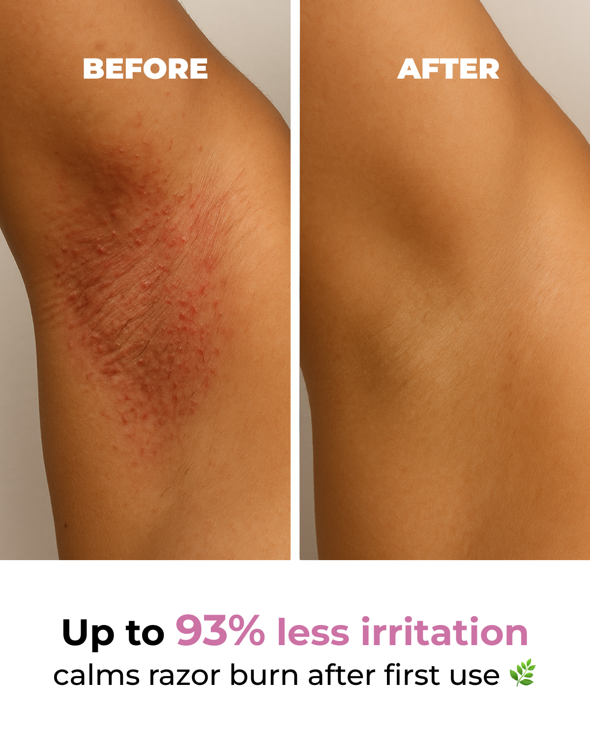 Viral Glazed Donut Aceite Post-Afeitado para Irritación y Manchas